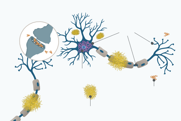 Synaptic loss